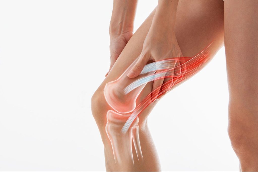 glutathione tendonitis Roles of Oxidative Stress in Acute Tendon Injury and Degenerative  TendinopathyA Target for Intervention