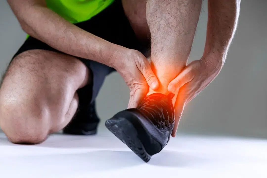 Symptoms of Peroneal Subluxation Singapore