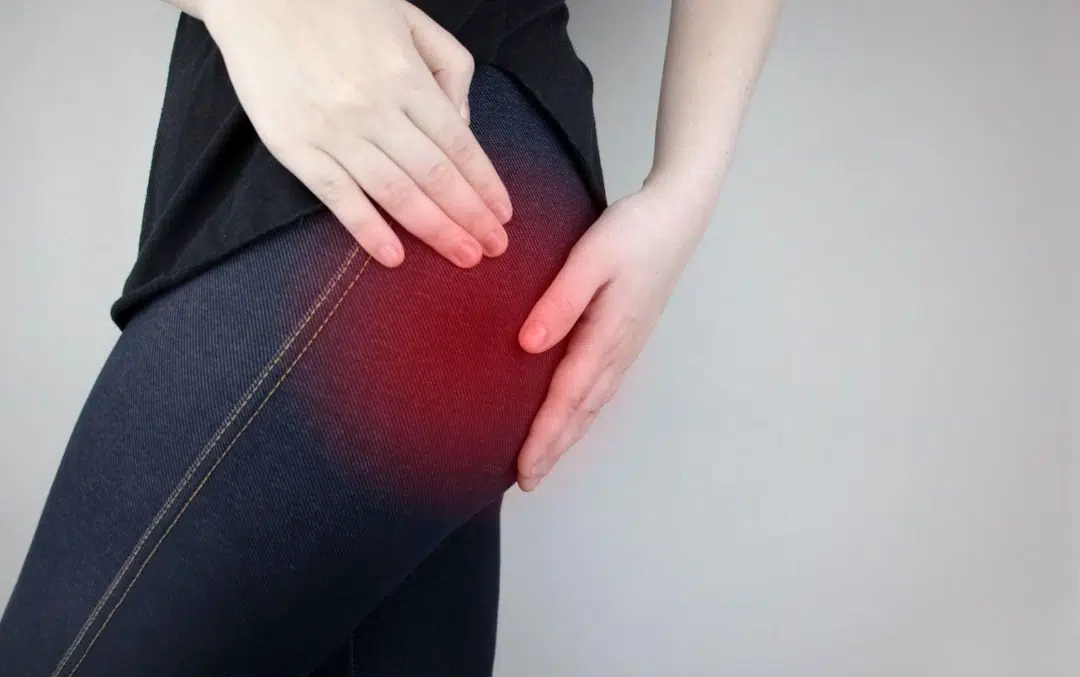 Symptoms of Piriformis Syndrome Singapore