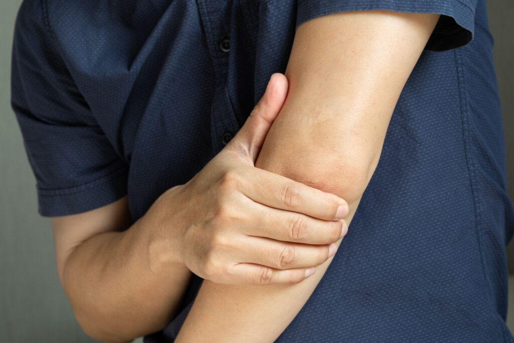 Symptoms of Radial Nerve Impingement Singapore