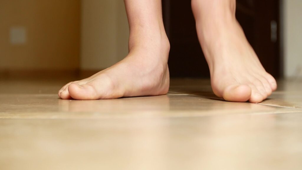 Flat foot (pes planus) showing a reduced arch in the foot.