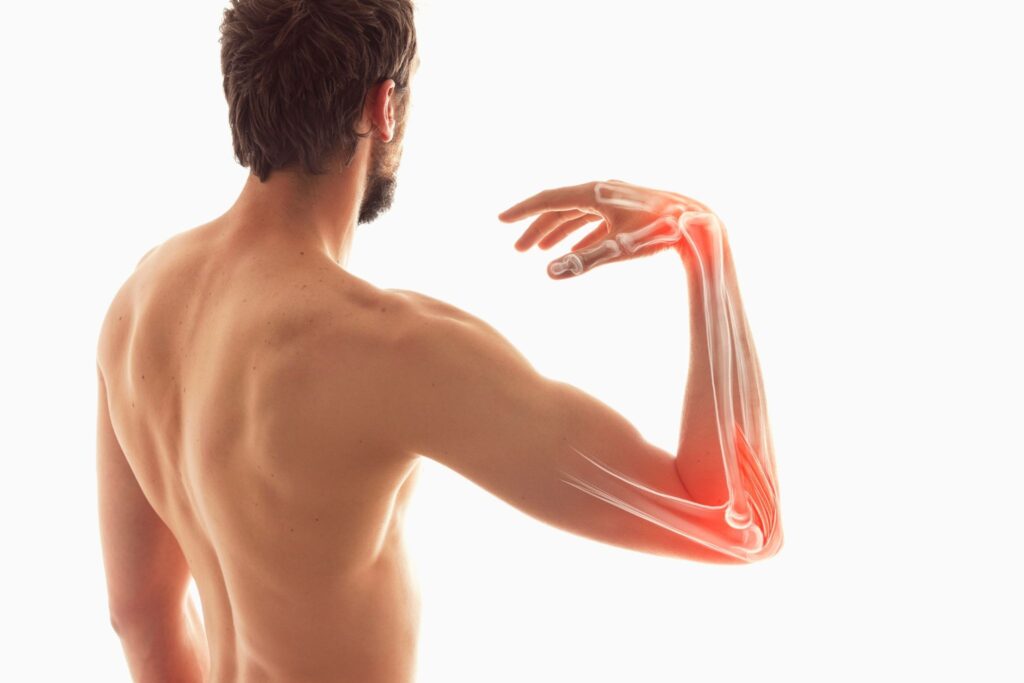 Symptoms of Triceps Tendinopathy Singapore