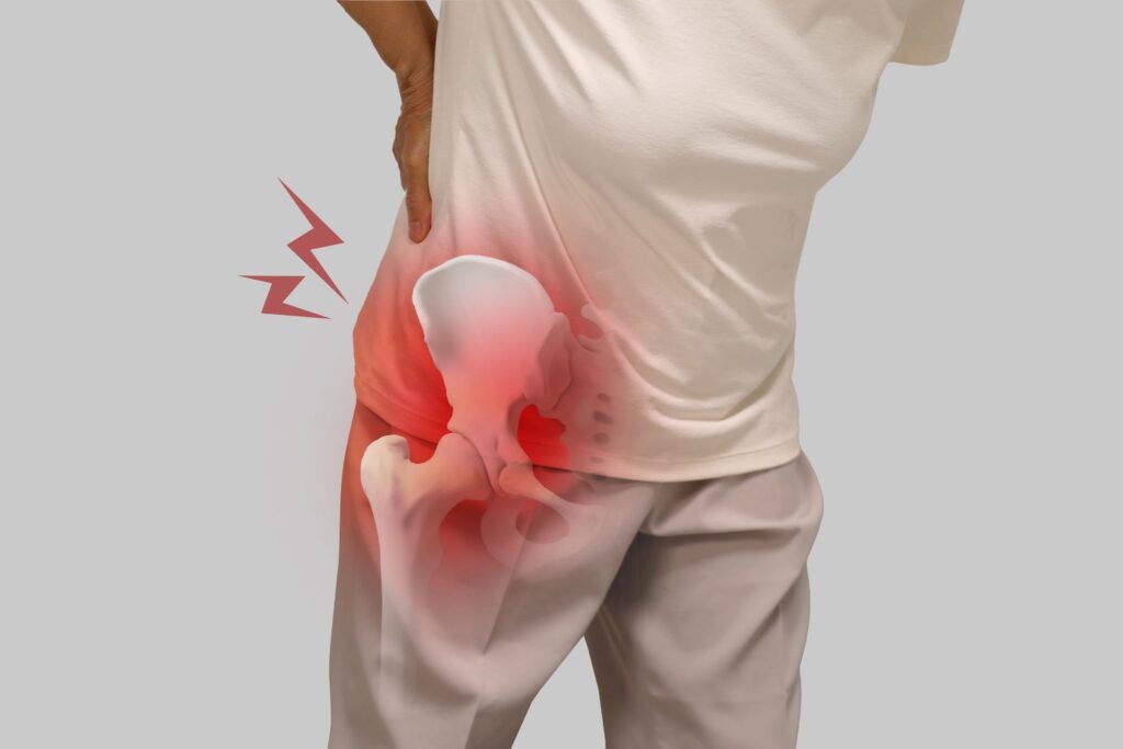 Hip Instability Singapore
