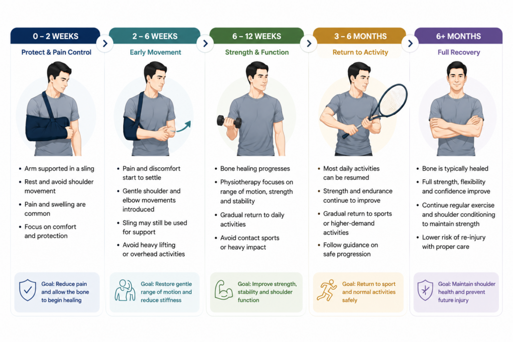 Recovery timeline infographic for a collarbone fracture showing rehabilitation from 0–2 weeks through 6+ months, including sling support, gradual return of shoulder movement, strengthening exercises and return to normal activities.